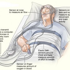 sleep studies for insomnia